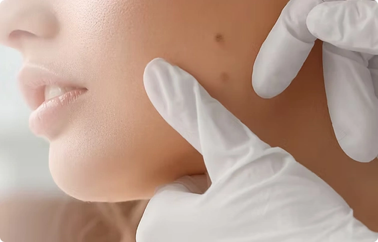 Skin Irregularities img