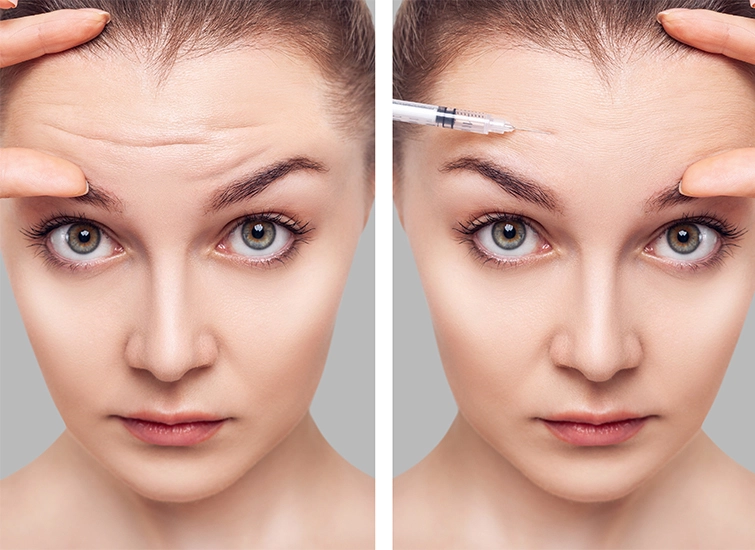 Before and After Botox: The Dos and Don’ts for Best Results